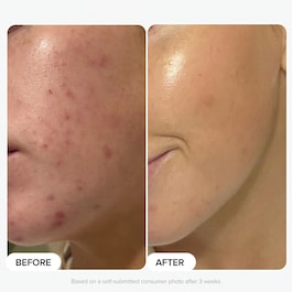 Skin Perfecting - Lotion Exfoliante 2 % BHA