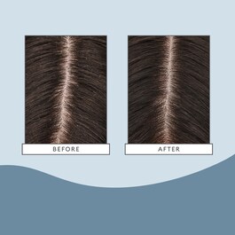 Scalp Revival - Masque Hydratant et rafraîchissant pour le cuir chevelu