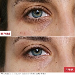 Skin Therapy  Eye - Crème yeux multi-perfectrice