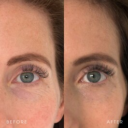 Black Tea Advanced Age Renewal Cream - Crème Hydratante Anti-âge Au Thé Noir