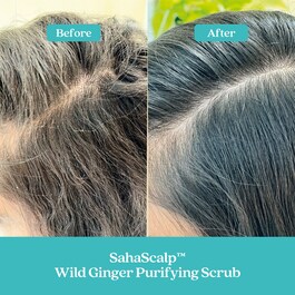 Kit de Remise à Zero du Cuir Chevelu SahaScalp™ - Coffret soin cheveux