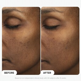 Skin Perfecting - Lotion Exfoliante 6 % Acide Mandélique + 2 % Acide Lactique