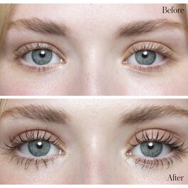 Duo Lift + Lumière Yeux - Duo pour les yeux