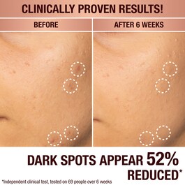 Dark Spot Correcting Radiance Recovery Serum - Sérum Anti-Taches