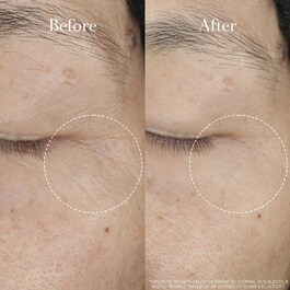 Tea Elixir Resilience Serum - Sérum Anti-âge à l'Acide Hyaluronique