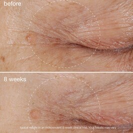 Biolumin-C Eye Serum - Contour des Yeux Éclaircissant à la Vitamine C