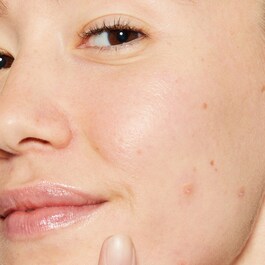 Deep Breakout Liquid Patch – Soin Anti-Imperfections