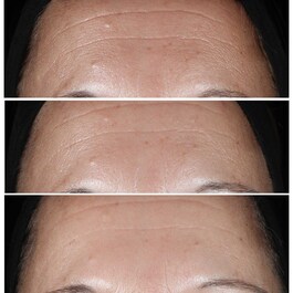Smart Clinical Repair™ - Sérum Correcteur Anti-rides