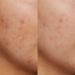 B3 Nice 10% Niacinamide - Sérum Eclat