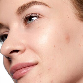 Acne Day Dot - Patchs Anti-Imperfections