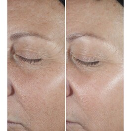 Smart Clinical Repair™ - Sérum Correcteur Anti-rides