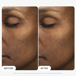 Multi-Level Exfoliation Trial Kit - Duo Découverte Exfoliants AHA + BHA