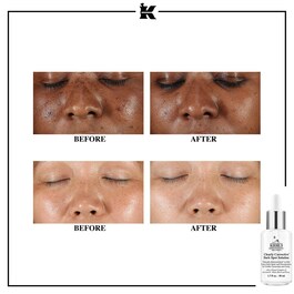 Sérum Anti-Taches à l'Acide Salicylique - Clearly Corrective™ Dark Spot Solution