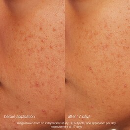 Daily Microfoliant - Exfoliant doux enzymatique et mécanique