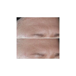 Vitamin C + Lactic - Soin Hydratant Intense Fermeté Lift