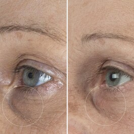 The Eye Cream Nomad - La crème pour les yeux Nomad