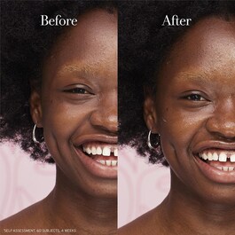 Rose Face Cream - Soin visage hydratant à la rose et à l’acide hyaluronique