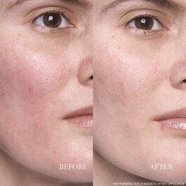 Lotus Resurfacing Dream Serum - Sérum de nuit anti-âge au lotus et aux AHAs