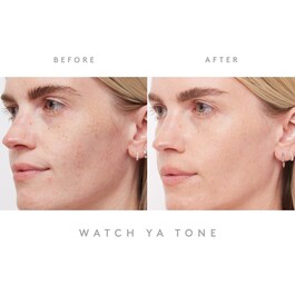 Watch Ya Tone - Sérum Anti-Tache Pigmentaire À La Niacinamide