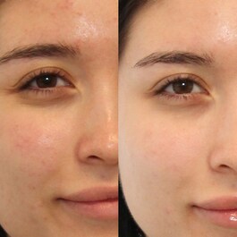 Contrôle des Imperfections - Matifiant contrôleur de brillance & des pores SPF45