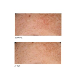 Alpha Beta® - Peeling Quotidien Formule Universelle