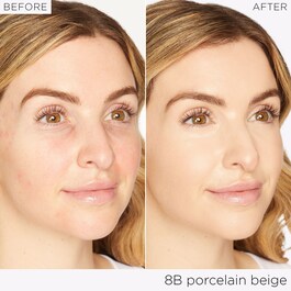 Shape Tape™ Radiant Concealer - Anticernes