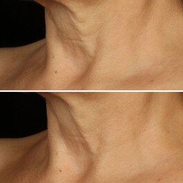 Smart Clinical Repair™ - Crème Liftante Visage + Cou