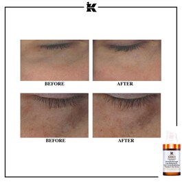 Crème Yeux anti-cernes à la Vitamine C - Powerful-Strength Line-Reducing Eye