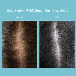 SahaScalp™ - Gommage Purifiant au Gingembre Sauvage
