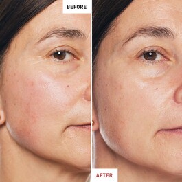 Skin Therapy  - Huile de nuit Multi-Perfectrice