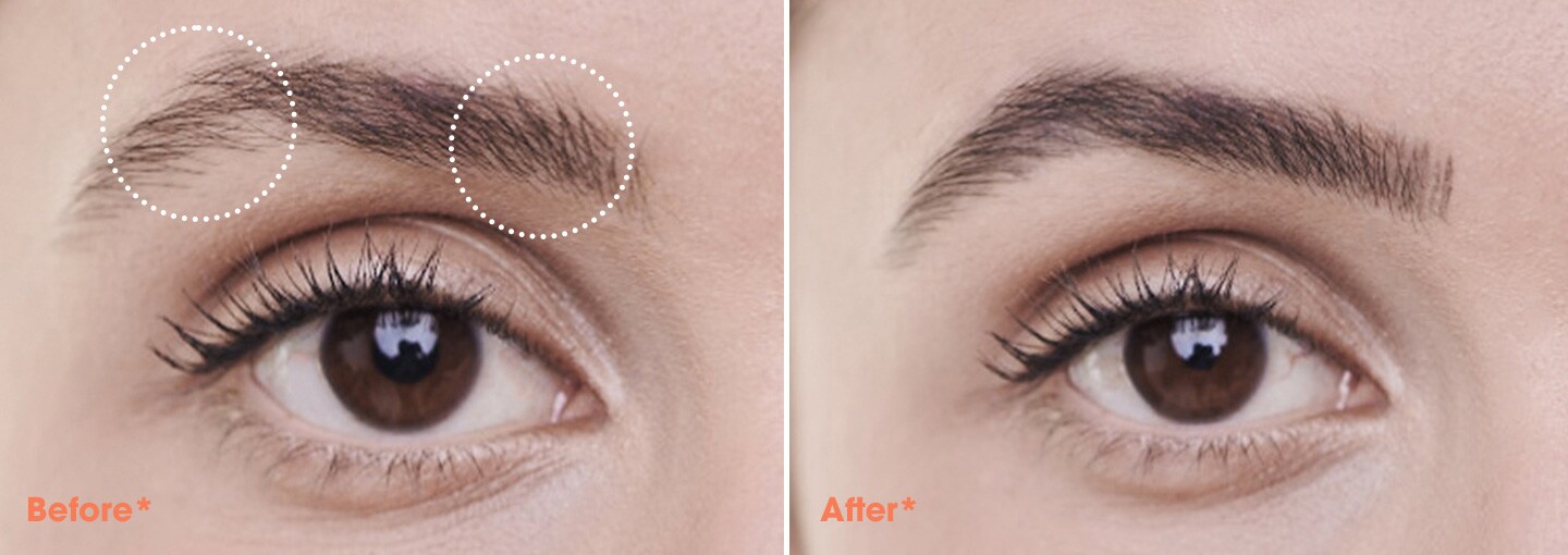 before_after_tatoo_effect