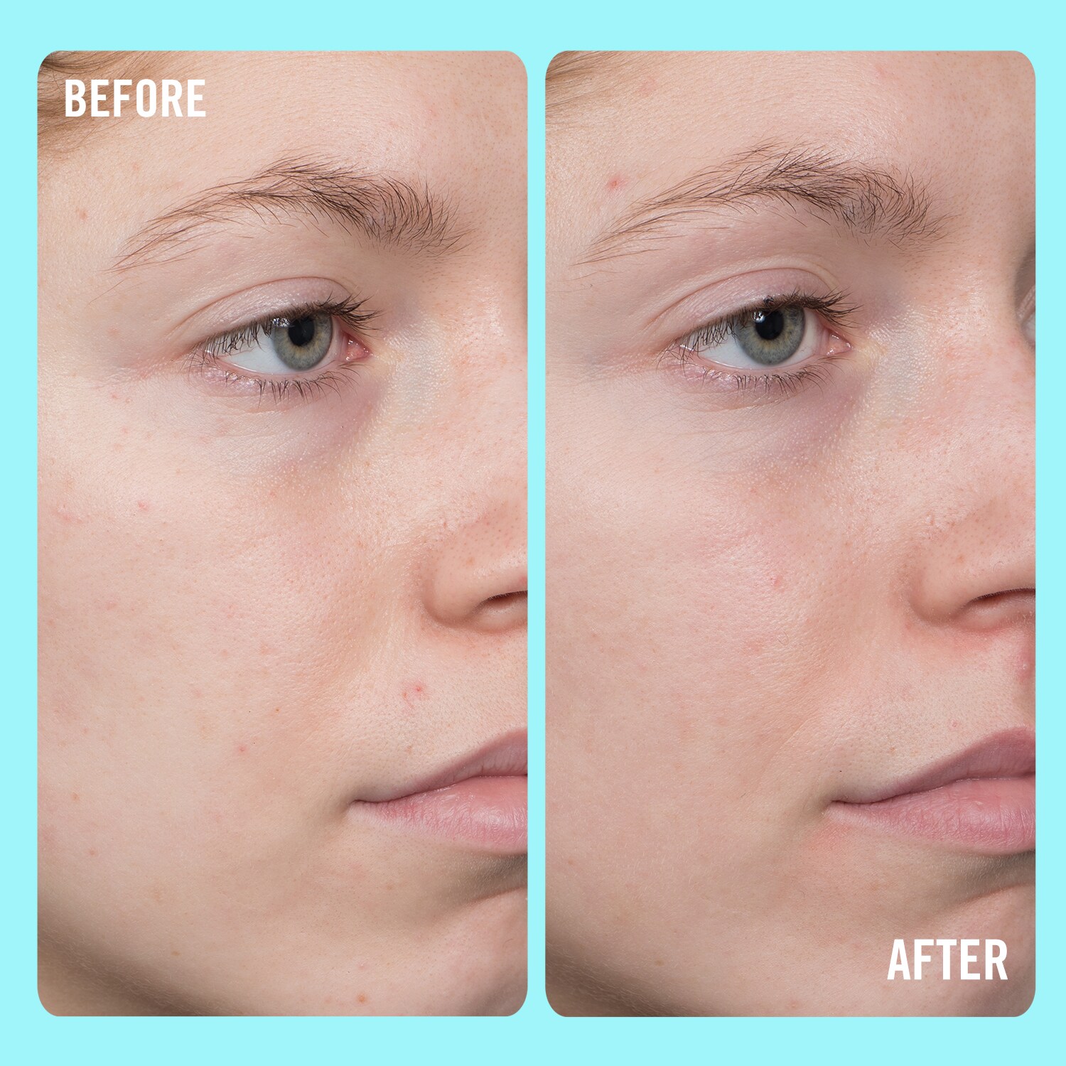 10 Vitamin C Brightening Serum Sérum Illuminateur avec 10 de