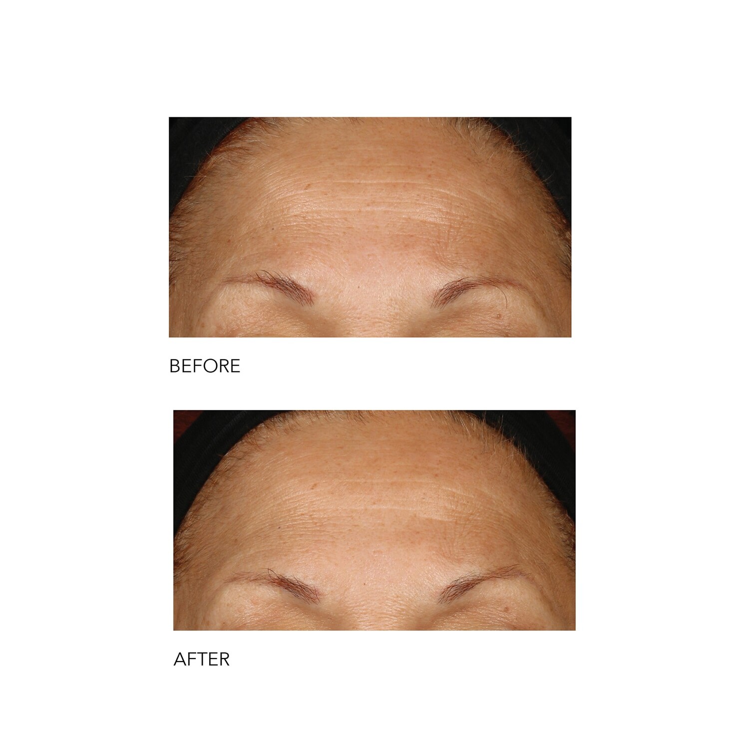 Alpha Beta® Peeling Quotidien Formule Intense de DR DENNIS GROSS ≡