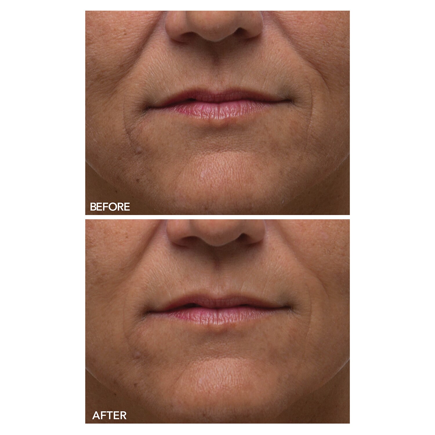 Alpha Beta Peeling Quotidien Formule UltraDouce de DR DENNIS GROSS ≡