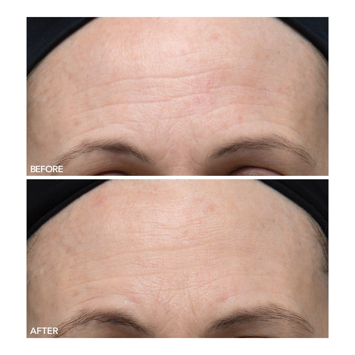 Alpha Beta® Peeling Quotidien UltraDouce de DR DENNIS GROSS ≡ SEPHORA