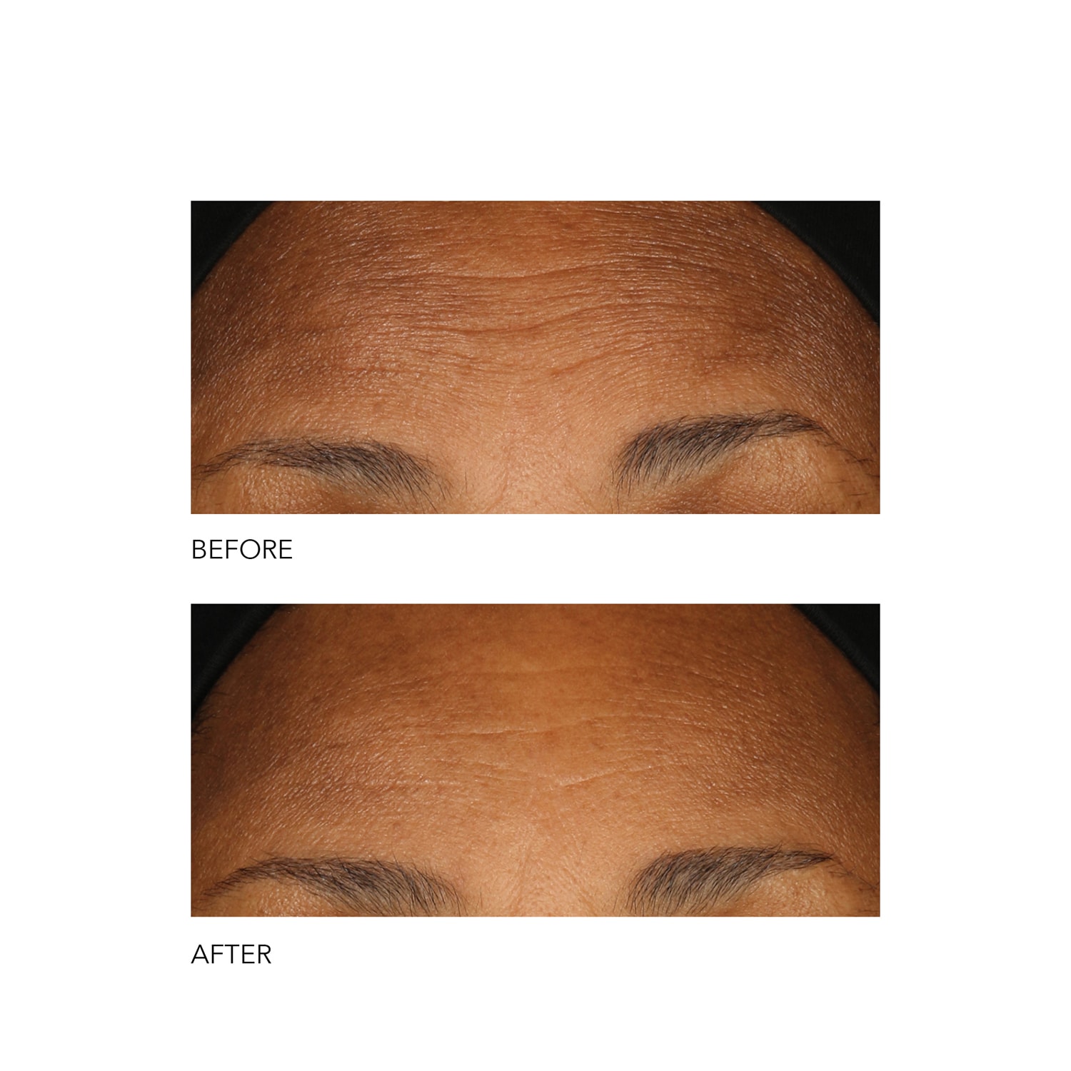 Alpha Beta® Peeling Quotidien Formule Intense de DR DENNIS GROSS ≡