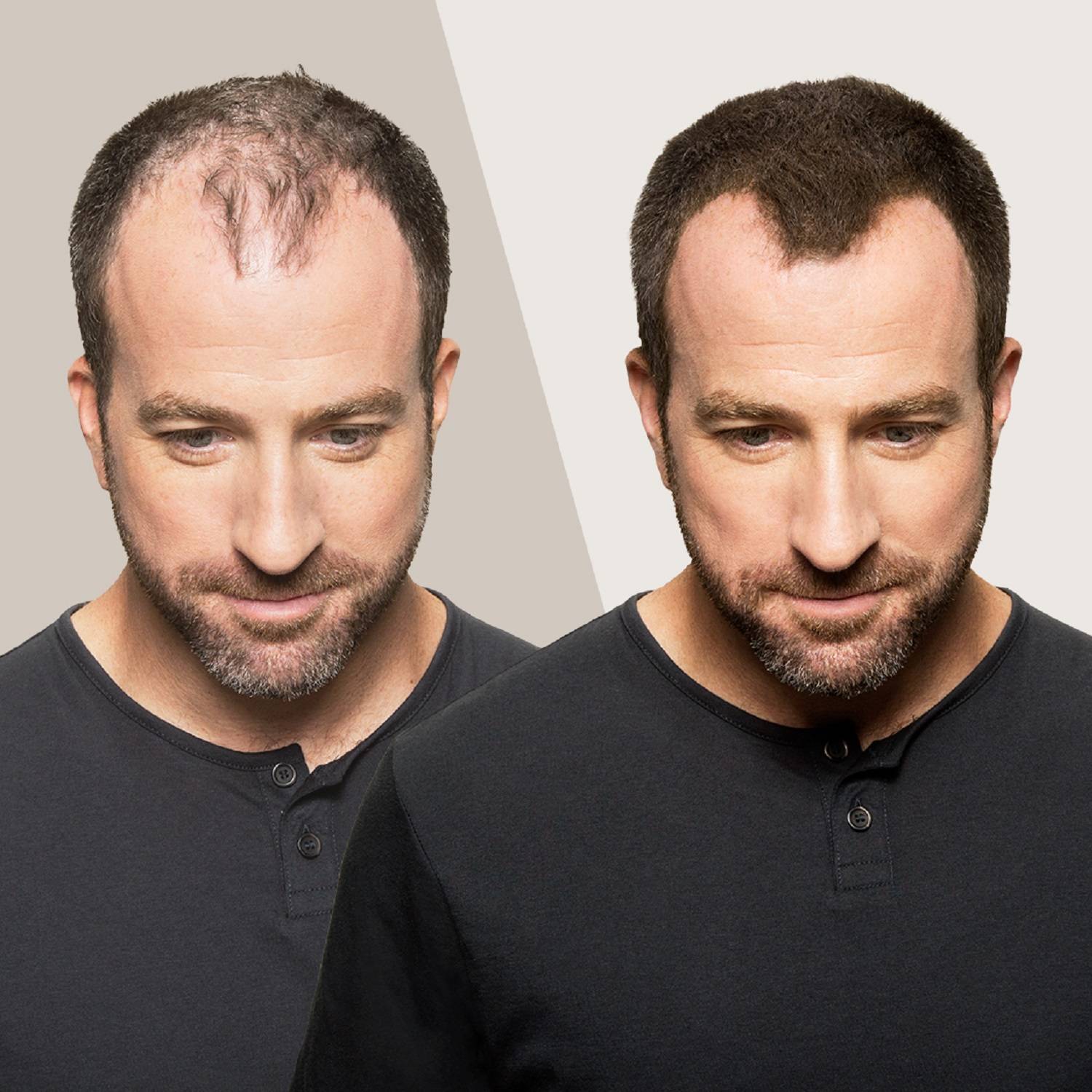 Hair Building Fibers Fibres Capillaires Densifiantes de TOPPIK ≡ SEPHORA