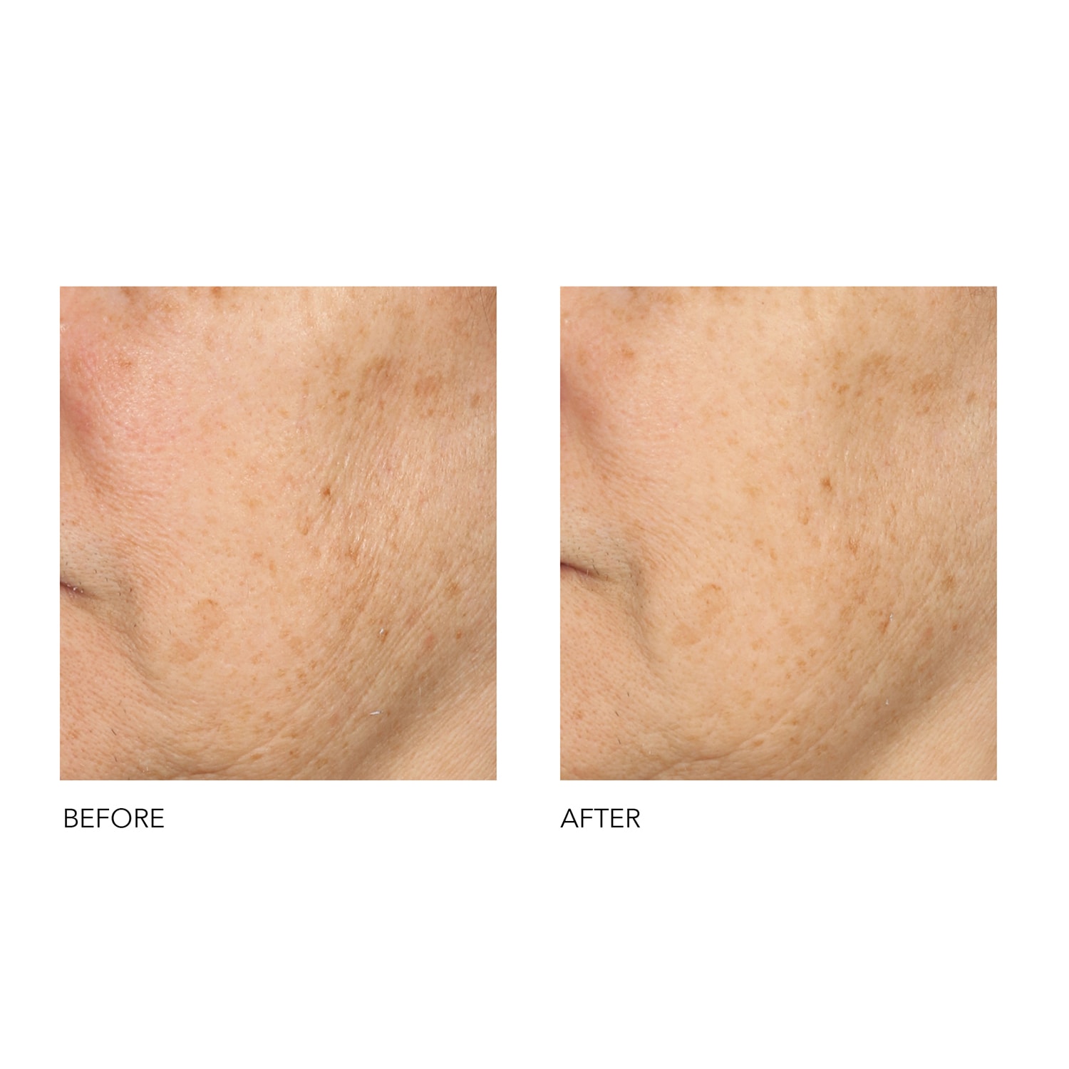 Alpha Beta® Peeling Quotidien Formule Universelle de DR DENNIS GROSS