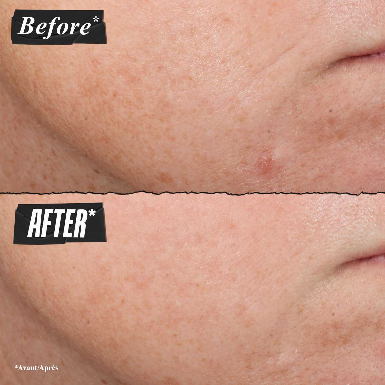 Retinol SkinRenewing Daily MicroDose Serum Sérum AntiÂge de KIEHL